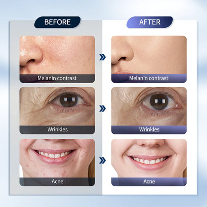 7 Colors LED Photon Machine